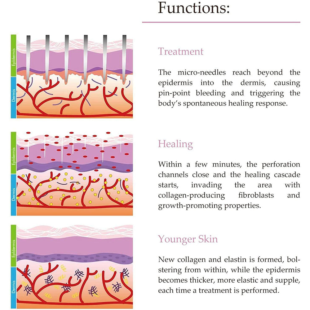 Micro Needling Face Roller