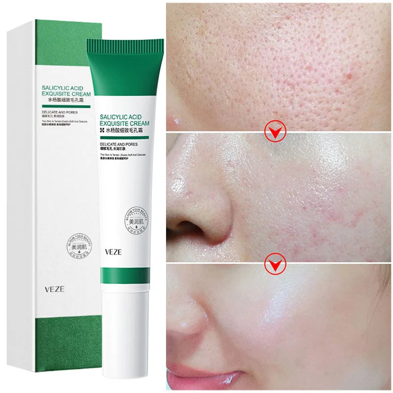 Pore-Refining Salicylic Acid Cream