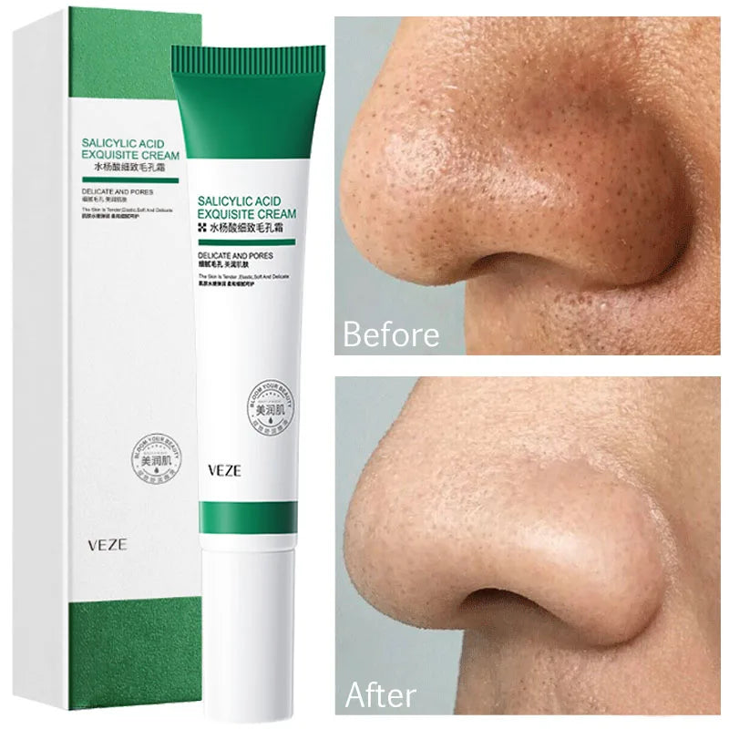Pore-Refining Salicylic Acid Cream
