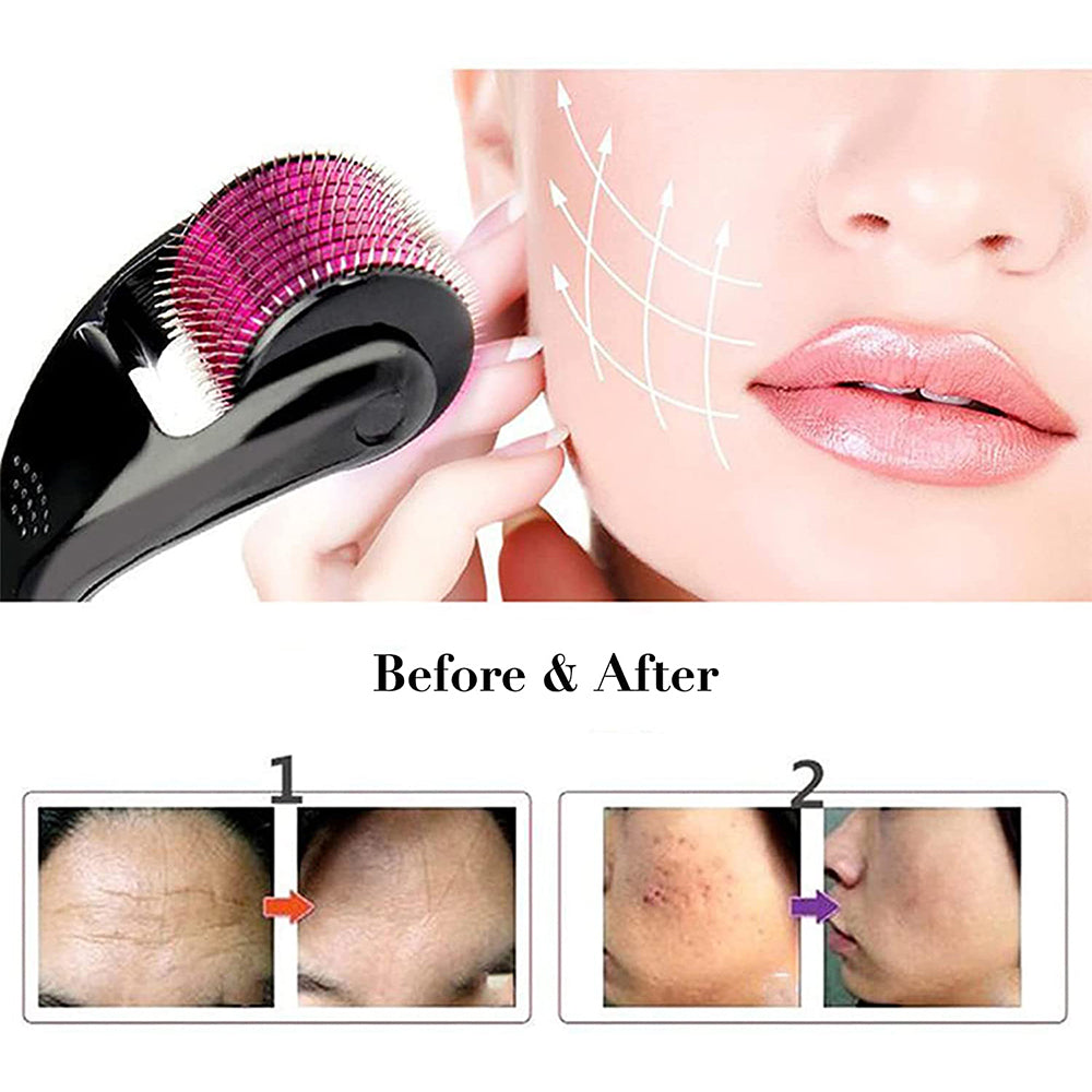 Micro Needling Face Roller